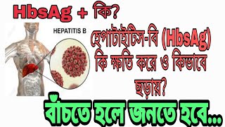 হেপাটাইটিসবি ভাইরাস HBsAg এর সকল তথ্য চিকিৎসা  HepatitisB virus HBStreatment [upl. by Naillig]