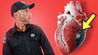 CARDIOGENIC SHOCK Explained In Under 6 Minutes [upl. by Lleryt]