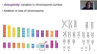 Chromosome abnormalities [upl. by Moor]