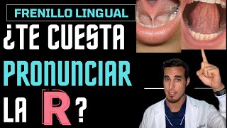 ¿Te cuesta PRONUNCIAR la letra R  Frenillo lingual corto [upl. by Campney]