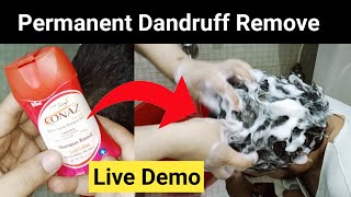 Anti Dandruff Medicated Shampoo Honest Review  Works Or Not  Conaz Lotion for Hair [upl. by Synned]