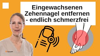 Eingewachsenen Zehennagel entfernen  Schmerzen beim Gehen loswerden [upl. by Reckford484]