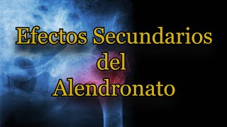 Efectos Secundarios del Alendronato [upl. by Elades]