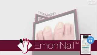 EmoniNail Toenail Fungus Treatment  Video Review [upl. by Adnilema]