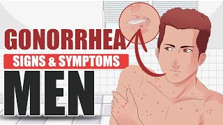 Signs and Symptoms of Gonorrhea in Men  sexually transmitted disease [upl. by Skardol338]