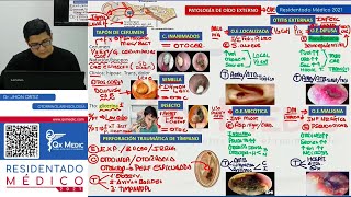 REPASO I  OTORRINOLARINGOLOGÍA [upl. by Anoi]