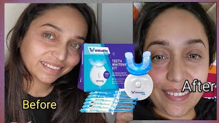 white bite pro teeth whitening kit for sensative teeth with LED light 35 carbamide peroxide [upl. by Gabbert837]