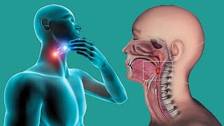 Throat Cancer Causes And Symptoms [upl. by Ornstead418]