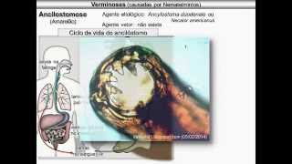 Verminoses causadas por nematelmintos [upl. by Atworth849]