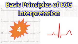 Basic Principles of ECG Interpretation  4 [upl. by Ezalb]