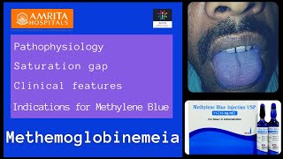 Methemoglobinemeia  Saturation gap  Methylene blue [upl. by Pollux119]