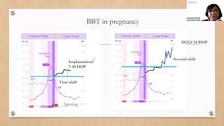 Tracking Your Basal Body Temperature  BBT Basics with Monica NFP Instructor [upl. by Lac]