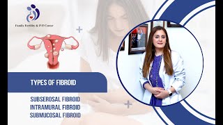 Fibroid Series Part 1  A Comprehensive Overview of Uterine Fibroid Types [upl. by Acinnad]