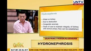 Hydronephrosis Swollen Kidney  Usapang Pangkalusugan [upl. by Leinaj312]