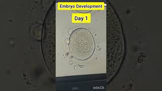 Embryo development process in IVF embryology embryodevelopment embryologist ivf ivfprocess [upl. by Rivers151]