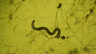 fungal predators of nematode worms [upl. by Snow]