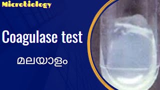 Coagulase test  malayalam [upl. by Emmeram]