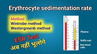 ESR  Erythrocyte sedimentation rate  in Hindi [upl. by Eek]