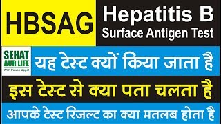 HBSAG Test Hepatitis B surface antigen test यह टेस्ट क्यों किया जाता है इस टेस्ट से क्या पता चलता है [upl. by Bullis142]