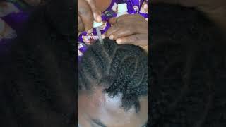 Asmr Scalp Scratching Oiling massage asmr asmrvideo scalpmassage hairoiling scalptreatment [upl. by Ninos]