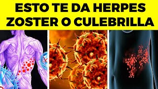 ¡ALERTA Este error común CAUSA herpes zóster o culebrilla  no lo hagas [upl. by Nivrac782]