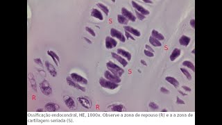 925  ATTO  Ossificação endocondral [upl. by Dewhirst]