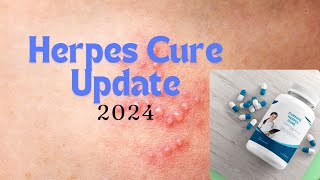 New Update on Herpes Cure  The Elementary Info [upl. by Fisch908]