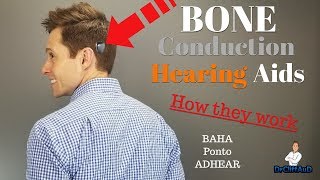 How Bone Conduction Hearing Aids Work  Cochlear BAHA Oticon Medical Ponto Medel ADHEAR [upl. by Neumeyer]