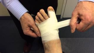 Redressing Following Minimally Invasive Bunion Surgery [upl. by Sparks]