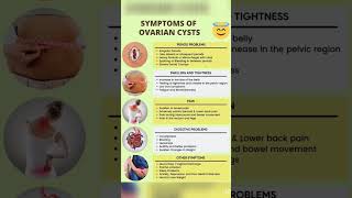 ovarian cyst signs and symptoms [upl. by Diskin]