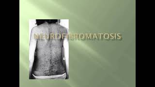 Neurofibromatosis Skin Examination mrcpch Clinical [upl. by Liba54]