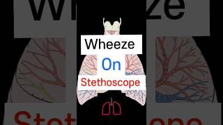 Wheeze on Stethoscope 🩺 Lung sound neetpg fmge medicalstudent [upl. by Anizor731]