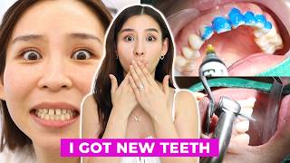 I Got a Dental Makeover in Korea 😬 🦷 [upl. by Tevis]