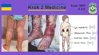 Krok 2 Medicine  Year 2019  112 Ministry of Public Health of Ukraine [upl. by Selim]