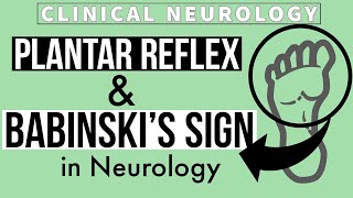 PLANTAR REFLEX  BABINSKIs SIGN  Equivocal Plantar  Other methods  Clinical Neurology [upl. by Piselli]