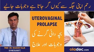 Uterovaginal Prolapse Causes amp Treatment  Pelvic Organ Prolapse  UterineReham Ke Girne Ka Ilaj [upl. by Coyle]