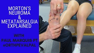 Mortons Neuroma and Metatarsalgia Whats the Difference [upl. by Leblanc]