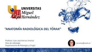 Anatomía radiológica del Tórax umh1967 202324 [upl. by Valle]