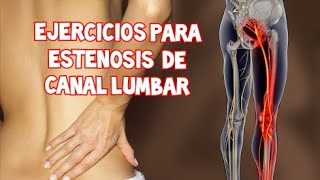 Ejercicios para ESTENOSIS DE CANAL LUMBAR [upl. by Hashim]