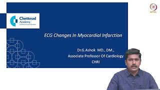 ECG changes in myocardial infarction [upl. by Barnie]