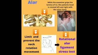 Alar ligament  what is function and importance of alar ligament in neck movement alarligament [upl. by Delano]