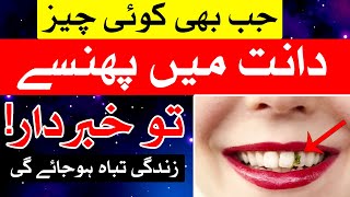 Dant Me Gosht Phase To Khabardar  Mehrban Ali  Teeth [upl. by Weidner]