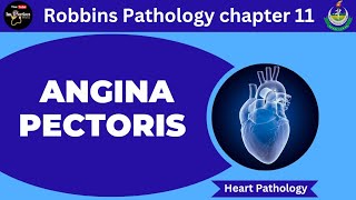 Angina PectorisRobbins Pathology 11Pathology lecturesHeart pathology pathology robbins heart [upl. by Sig]