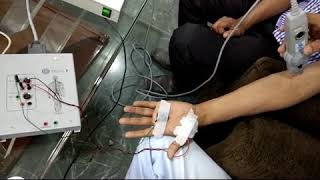 EMG test demonstration  Electromyography EMG [upl. by Ardnauqal355]