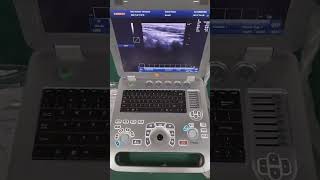 SUN800F pw doppler ultrasound with linear probe [upl. by Immas311]