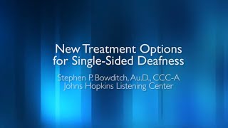 New Cochlear Implantation Treatment Options for SingleSided Deafness [upl. by Murton]