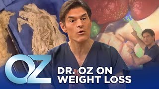 Dr Oz on Weight Loss  Oz Weight Loss [upl. by Llekram]