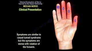 Median nerve injury causes symptoms diagnosis and treatment Carpal tunnel syndrome diagnosis [upl. by Eannaj]