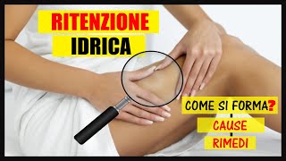 Ritenzione idrica cosè Come si forma Quali sono le cause e i rimedi [upl. by Hannasus894]