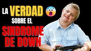 🔴LAS 7 COSAS QUE DEBES SABER SOBRE EL SINDROME DE DOWN  The Truth About Down Syndrome [upl. by Acinorehs]